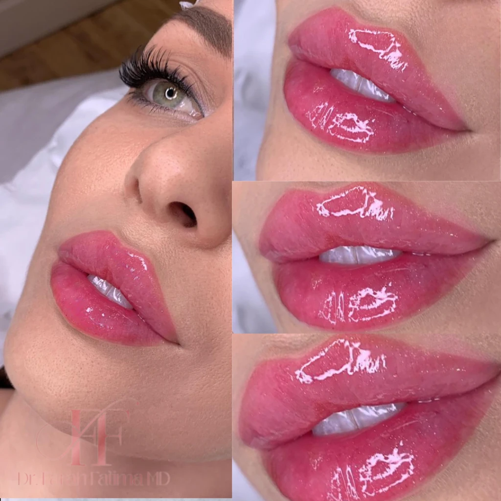 Beauty Lyft Med Spa