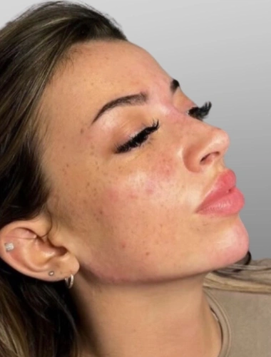 Beauty Lyft Med Spa