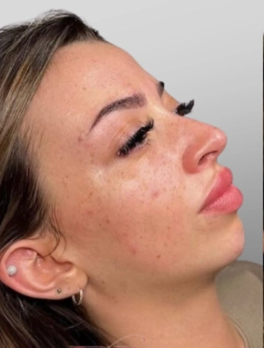 Beauty Lyft Med Spa