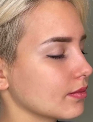 Beauty Lyft Med Spa
