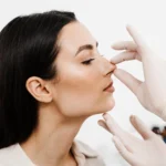 Liquid Rhinoplasty